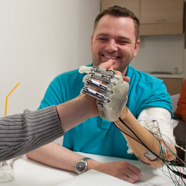 Dennis Aabo Sorensen tests a prosthetic arm with sensory feedback in a laboratory in Rome in March 2013.